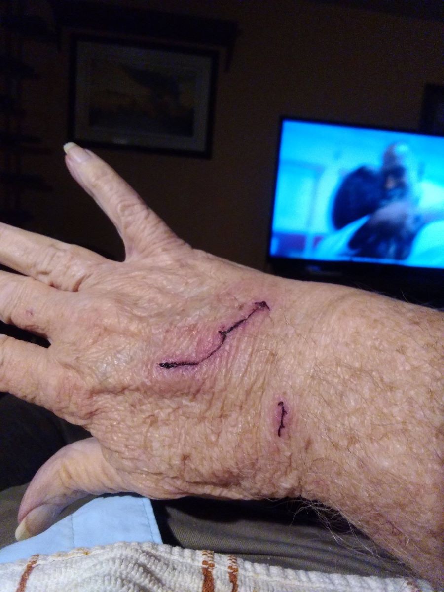Back of my hand.jpg